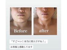 ディアンヌ(Diane)の雰囲気（[衝撃before＆after]若見えー10歳!下半身むくみ冷え.産後19kg減）