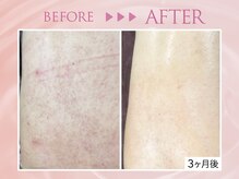 クリアラボ 川崎(Clear Lab)/韓国式肌管理&毛穴洗浄専門店