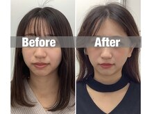 ハリサロンドオフ 堺東店(hari salon de off)/お客様before→after