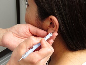 グリッタープラス(glitter plus)/耳つぼジュエリー施術風景