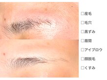 ピュアノア 垂水店/ 産毛脱毛 顔脱毛　神戸垂水明石