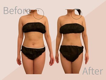 ファミーユ 名古屋店/【ブライダルケア】肩こり、痩身