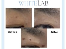 ヴィーナス 浦安店(VENUS)/ホワイトラボ