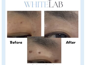 ヴィーナス 浦安店(VENUS)/ホワイトラボ