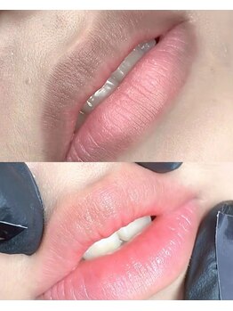 アネモネ ビューティーズ サロン(Anemone Beauty's salon)/ドールピンクBefore→After