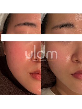 ジュエッテ(jouete)/ウルドム管理