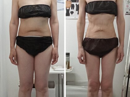 輝 らいとの写真