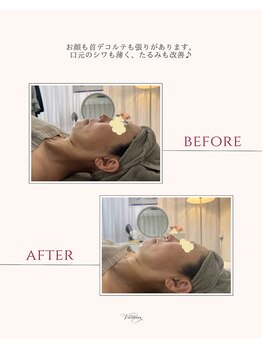 ヴィオルネ(VIE ORNER)/