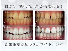 ホワイトニングショップ 多摩店の雰囲気（ホワイトニングは継続がポイント!白い歯目指そう!）