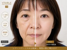 ジュビル(JUBIL)