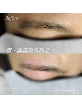サロンロンウーマン(SALON RON woman)/眉毛脱毛
