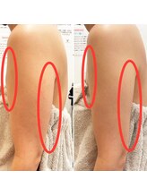 みつばちさろん/【ブラックスタンプ】二の腕