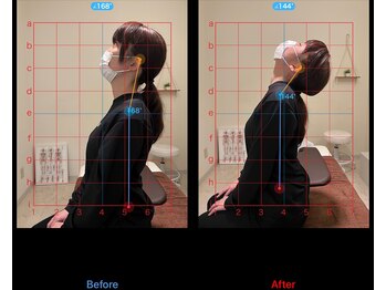 エム アンド エス(M&S)/施術前後の写真