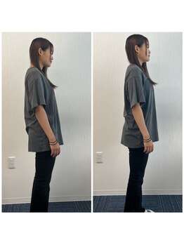 パシオン接骨院 整体院/ビフォーアフター