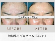 トータルビューティー マインド(Total Beauty)/プログラム（4ヶ月）