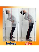 ストレッチヒーロー 福山神辺店/ビフォーアフター【1回の変化】