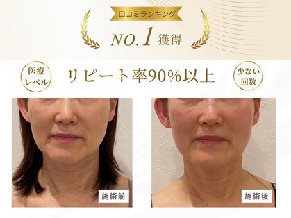 スパイア(SPIRE)の写真