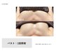 切らない。IPLを使った光バストケア　¥12000→¥5000