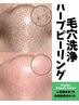 PR用｜毛穴レス肌｜毛穴引き締め｜毛穴改善｜毛穴の黒ずみケア