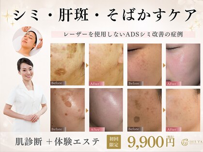 ベルタ(BELTA)の写真