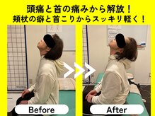 てあつい整体院 たかす院/