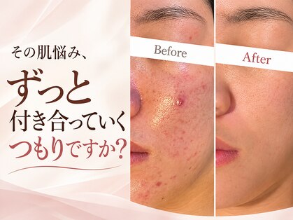 エープラス 日立(Aplus)の写真