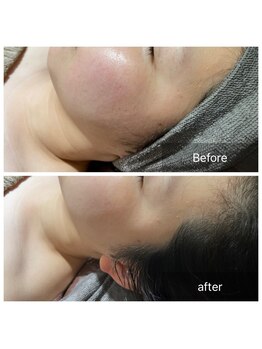 グレイス(Grace)/寝てるだけ！浮腫みスッキリ解消