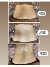 イーストモア(EAST MOIS)/ウエスト1ヶ月before～after