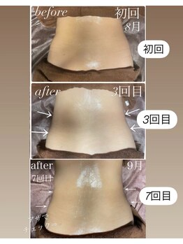 イーストモア(EAST MOIS)/ウエスト1ヶ月before～after