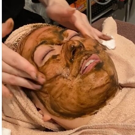 【ナークハーブピーリング剥離の少ないソフトピーリング】ダウンタイム少なめ