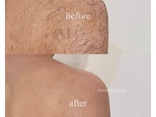 ハリウッドブロウリフト ワクシー 表参道店(HOLLYWOOD BROW LIFT WAXYYY.)/メンズ脱毛