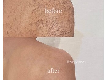 ハリウッドブロウリフト ワクシー 表参道店(HOLLYWOOD BROW LIFT WAXYYY.)/メンズ脱毛