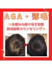 【オンライン無料相談】育毛促進カウンセリング　0円