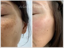 エクラデボーテ(eclat de beaute)の雰囲気（☆美肌プログラムホームケアのみ☆R5/12～R7/3）