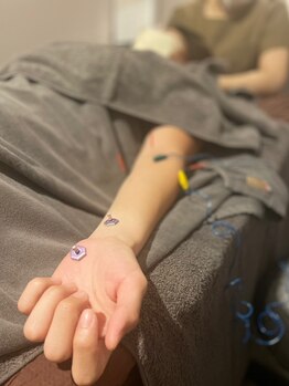 天使のたまご 新宿院/産前産後の手首の痛み 施術風景