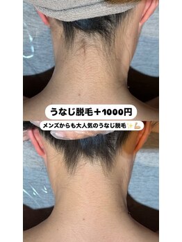 ルウム 金山店(lum)/脱毛lum/襟足・うなじ美人に☆