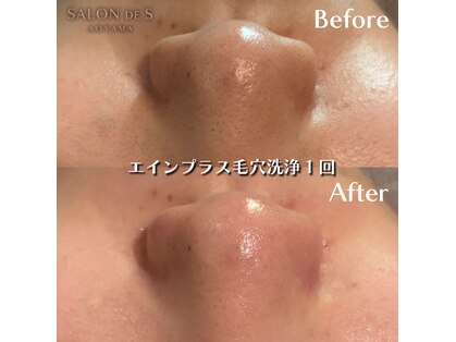 サロン ド エス アオヤマ(SALON DE S AOYAMA)の写真