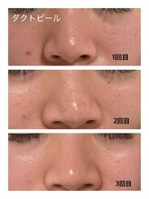 ベルシャトン(Belle Chaton)/