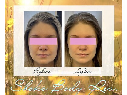 ショウコ ボディ レヴ(SHOKO Body Rev.)の写真