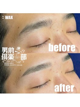 男前倶楽部/脱毛/メンズ脱毛/メンズ専門店
