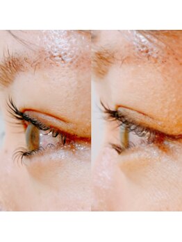 アディクト 恵比寿店(ADDICT)/逆さまつげの下まつ毛