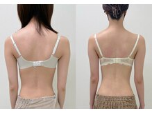 ワイサロン(Y salon)/バストアップ/4ヶ月/B→Dカップ