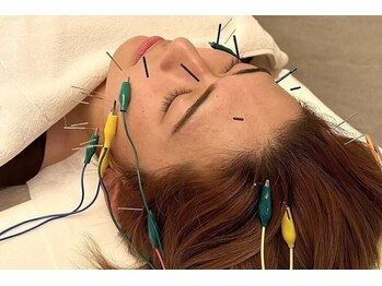 デルタエヌピー63+(δnp63+)/お客様の施術風景【小顔/薬院】