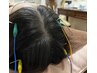 【気になる頭皮のお悩みに】頭皮鍼&ヘッドマッサージ