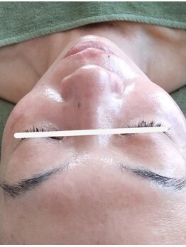 ウイユ(Oeil)/ピーリング直後 当日予約お勧め