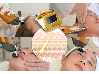 アンテイン(anthein)の写真