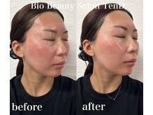 テンディ(TenD.)/レストセルトリートメント