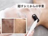 【シミ/乾燥が気になる方に】潤い艶肌へ!肌質改善フェイシャル 70分/13200→