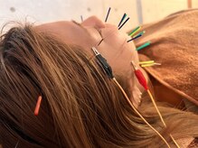 ハリトマト 梅田中崎/施術（たるみ・ハリ施術）