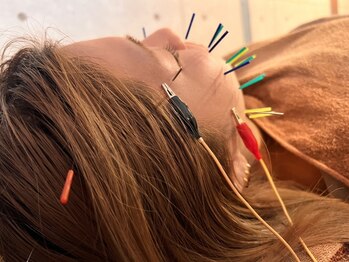 ハリトマト 梅田中崎/施術(たるみ・ハリ施術)